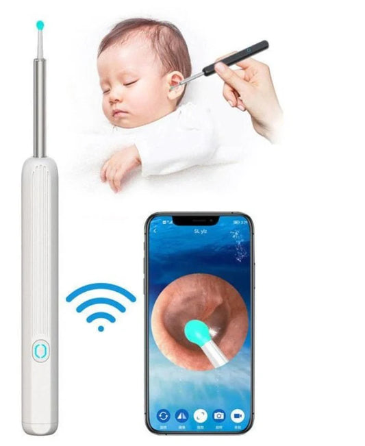 Smart Visual Earwax Removal Tool